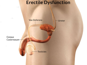 Erektile Dysfunktion Germany