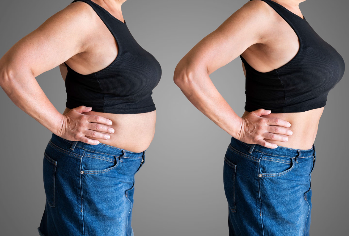 Keto Slim Kapsel